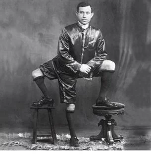 Франческо Лентини, человек с тремя ногами (фото)