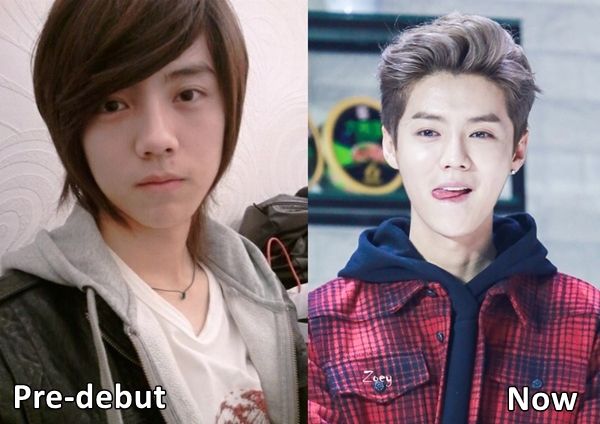 Корейские актеры до и после пластики. Кто из корейских актеров делал пластику