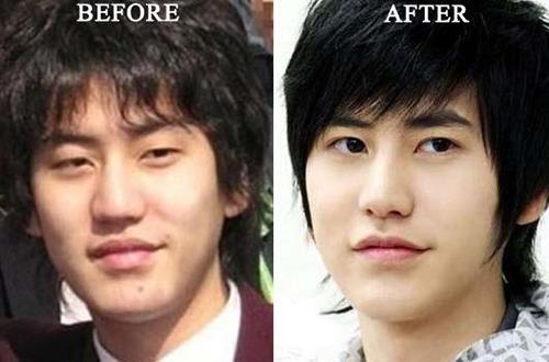 Корейские актеры до и после пластики. Кто из корейских актеров делал пластику