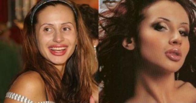 Светлана Лобода: до и после пластики, фото